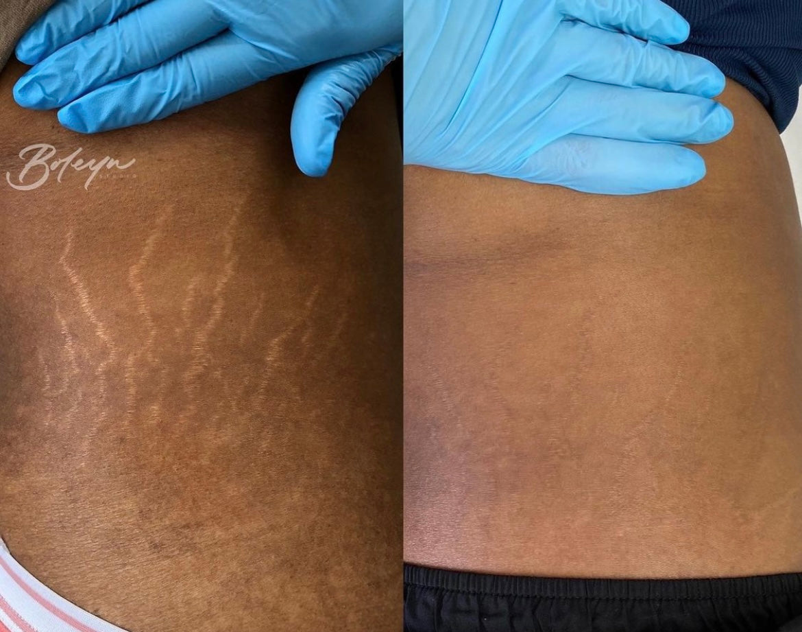 ⁠Boleyn Treatment Gallery