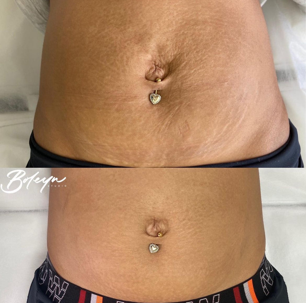 Boleyn Special Gallery